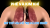 Phế Và Kim Khí – Hơi Thở Của Vũ Trụ Và Con Người (Bài 02)