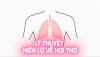 Lý Thuyết Hiển Lộ Về Hơi Thở (Bài 02)