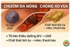 Cặp Đá Diệu Kỳ: Câu Chuyện Thầy Dư Quang Châu Chữa Lành Xơ Vữa Động Mạch (bài 4)