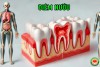 Chữa Viêm Nha Chu Bằng Ru. Ớt Dư Quang Châu và Bài Thuốc Dân Gian (bài 12)