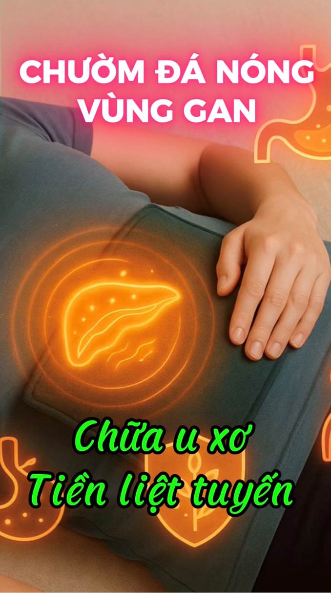 Chườm Đá Nóng Chữ U Xơ Tuyến Tiền Liệt (Bài 40)